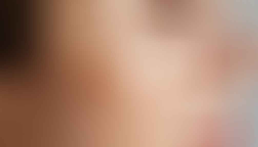 azelaic acid acne treatment