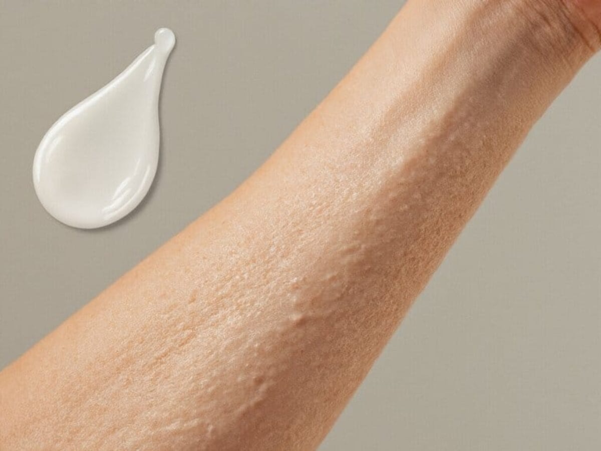 signs of dry skin